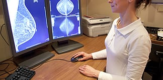 Adesão ao rastreio do cancro da mama abaixo de 23% em Lisboa e Vale do Tejo e Alentejo